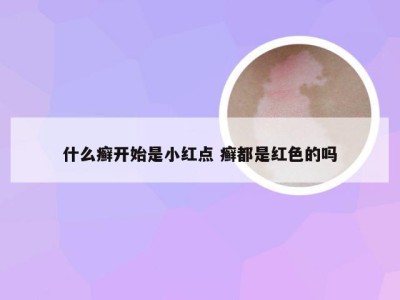 什么癣开始是小红点 癣都是红色的吗