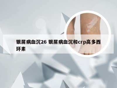 银屑病血沉26 银屑病血沉和crp高多西环素