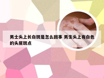 男士头上长白斑是怎么回事 男生头上有白色的头屑斑点