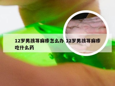 12岁男孩荨麻疹怎么办 12岁男孩荨麻疹吃什么药