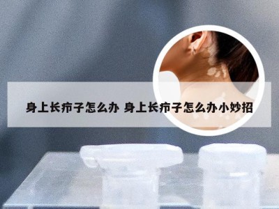 身上长疖子怎么办 身上长疖子怎么办小妙招