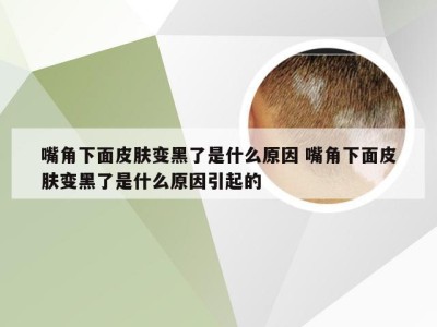 嘴角下面皮肤变黑了是什么原因 嘴角下面皮肤变黑了是什么原因引起的