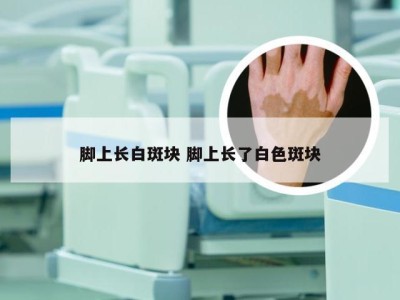 脚上长白斑块 脚上长了白色斑块