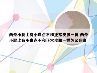 两条小腿上有小白点不和正常皮肤一样 两条小腿上有小白点不和正常皮肤一样怎么回事