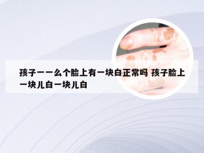 孩子一一么个脸上有一块白正常吗 孩子脸上一块儿白一块儿白