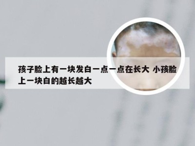 孩子脸上有一块发白一点一点在长大 小孩脸上一块白的越长越大