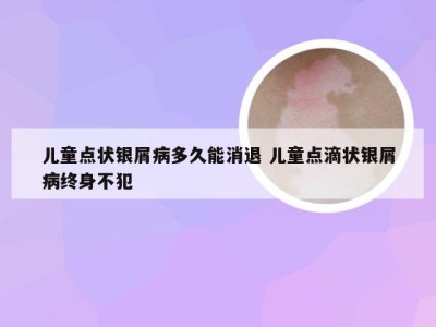 儿童点状银屑病多久能消退 儿童点滴状银屑病终身不犯