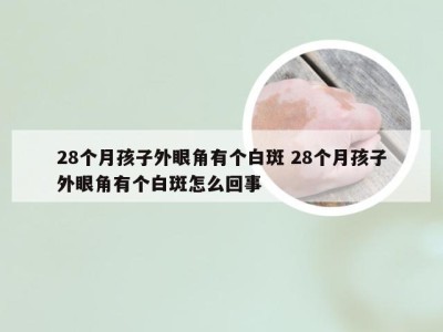 28个月孩子外眼角有个白斑 28个月孩子外眼角有个白斑怎么回事