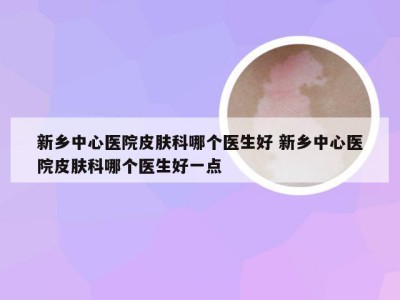 新乡中心医院皮肤科哪个医生好 新乡中心医院皮肤科哪个医生好一点