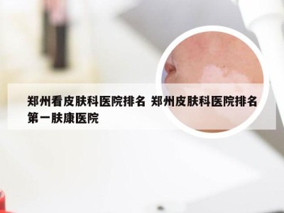 郑州看皮肤科医院排名 郑州皮肤科医院排名第一肤康医院