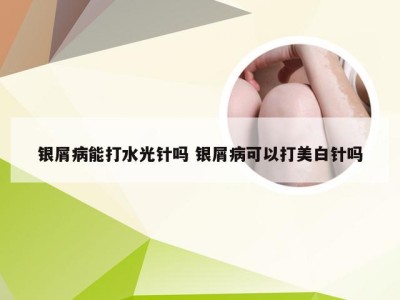 银屑病能打水光针吗 银屑病可以打美白针吗