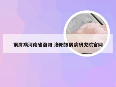 银屑病河南省洛阳 洛阳银屑病研究院官网