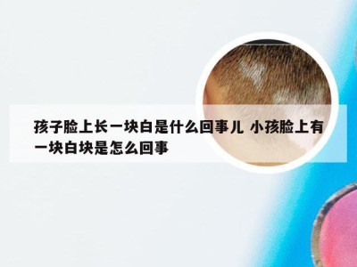 孩子脸上长一块白是什么回事儿 小孩脸上有一块白块是怎么回事