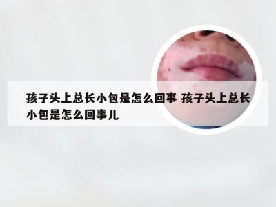 孩子头上总长小包是怎么回事 孩子头上总长小包是怎么回事儿