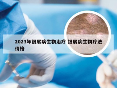 2023年银屑病生物治疗 银屑病生物疗法价格