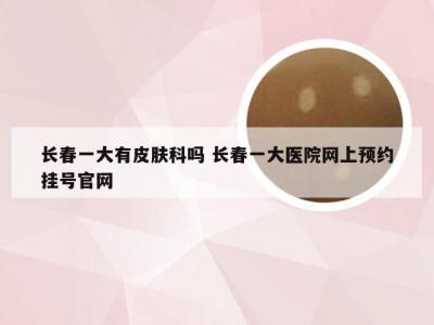 长春一大有皮肤科吗 长春一大医院网上预约挂号官网