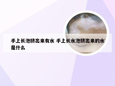 手上长泡挤出来有水 手上长水泡挤出来的水是什么