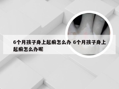 6个月孩子身上起癣怎么办 6个月孩子身上起癣怎么办呢