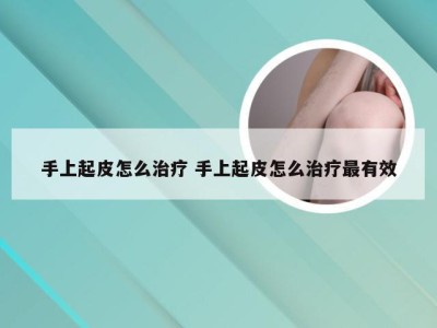 手上起皮怎么治疗 手上起皮怎么治疗最有效