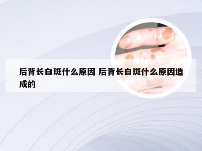 后背长白斑什么原因 后背长白斑什么原因造成的