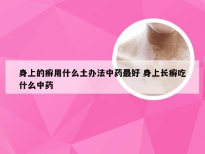 身上的癣用什么土办法中药最好 身上长癣吃什么中药