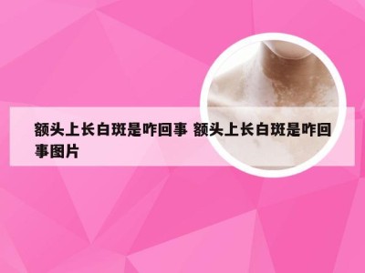 额头上长白斑是咋回事 额头上长白斑是咋回事图片