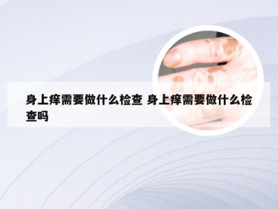 身上痒需要做什么检查 身上痒需要做什么检查吗