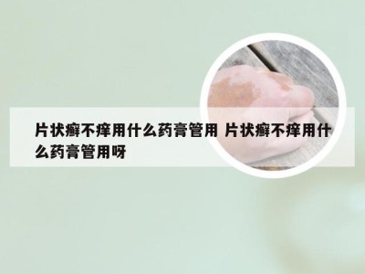 片状癣不痒用什么药膏管用 片状癣不痒用什么药膏管用呀