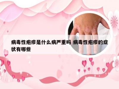 病毒性疱疹是什么病严重吗 病毒性疱疹的症状有哪些