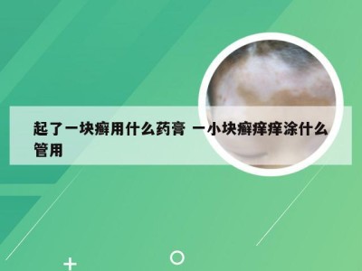 起了一块癣用什么药膏 一小块癣痒痒涂什么管用