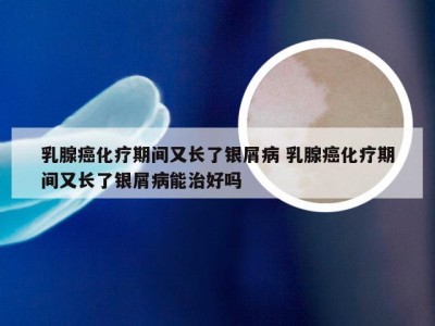 乳腺癌化疗期间又长了银屑病 乳腺癌化疗期间又长了银屑病能治好吗