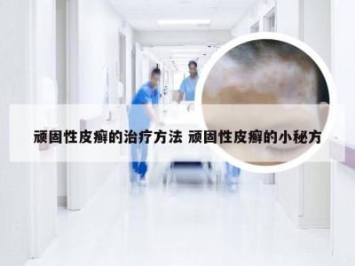 顽固性皮癣的治疗方法 顽固性皮癣的小秘方