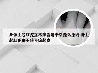 身体上起红疙瘩不痒就是干裂是么原因 身上起红疙瘩不疼不痒起皮