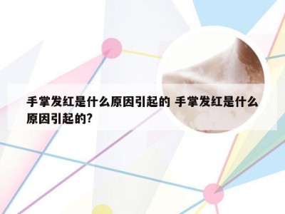 手掌发红是什么原因引起的 手掌发红是什么原因引起的?