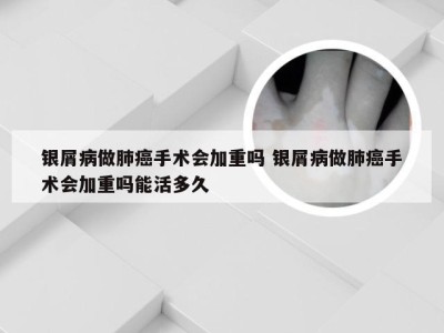 银屑病做肺癌手术会加重吗 银屑病做肺癌手术会加重吗能活多久