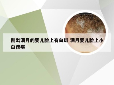 刚出满月的婴儿脸上有白斑 满月婴儿脸上小白疙瘩