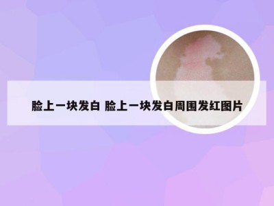 脸上一块发白 脸上一块发白周围发红图片