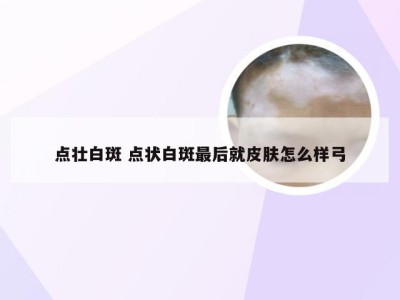 点壮白斑 点状白斑最后就皮肤怎么样弓