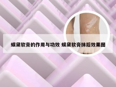 蜈黛软膏的作用与功效 蜈黛软膏抹后效果图