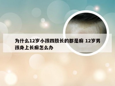 为什么12岁小孩四肢长的都是癣 12岁男孩身上长癣怎么办