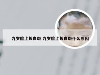 九岁脸上长白斑 九岁脸上长白斑什么原因