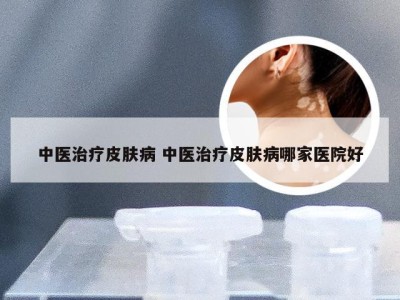 中医治疗皮肤病 中医治疗皮肤病哪家医院好