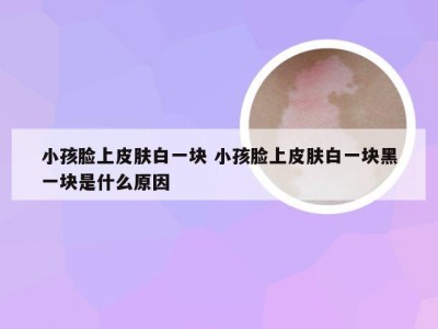 小孩脸上皮肤白一块 小孩脸上皮肤白一块黑一块是什么原因