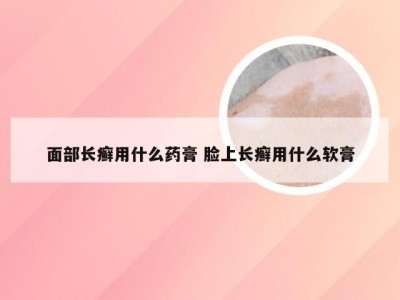 面部长癣用什么药膏 脸上长癣用什么软膏