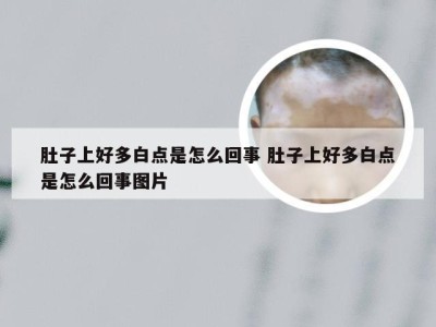 肚子上好多白点是怎么回事 肚子上好多白点是怎么回事图片