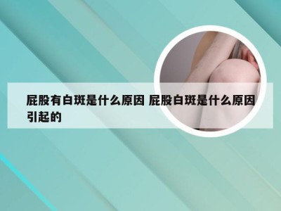 屁股有白斑是什么原因 屁股白斑是什么原因引起的