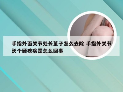 手指外面关节处长茧子怎么去除 手指外关节长个硬疙瘩是怎么回事