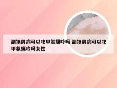 副银屑病可以吃甲氨蝶呤吗 副银屑病可以吃甲氨蝶呤吗女性