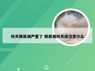 秋天银屑病严重了 银屑病秋天应注意什么