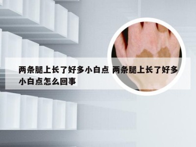 两条腿上长了好多小白点 两条腿上长了好多小白点怎么回事